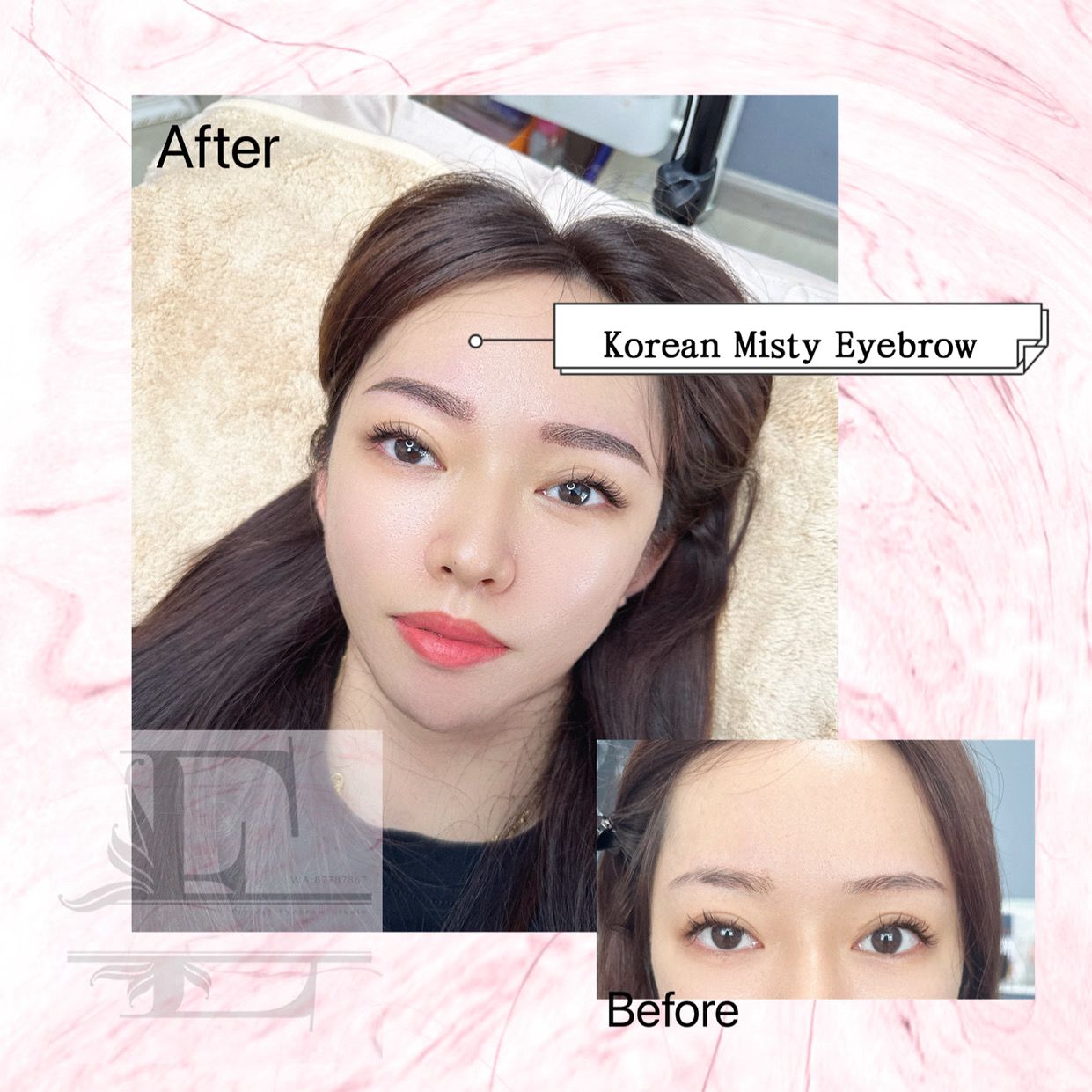 Beauty treatment sample photo 1