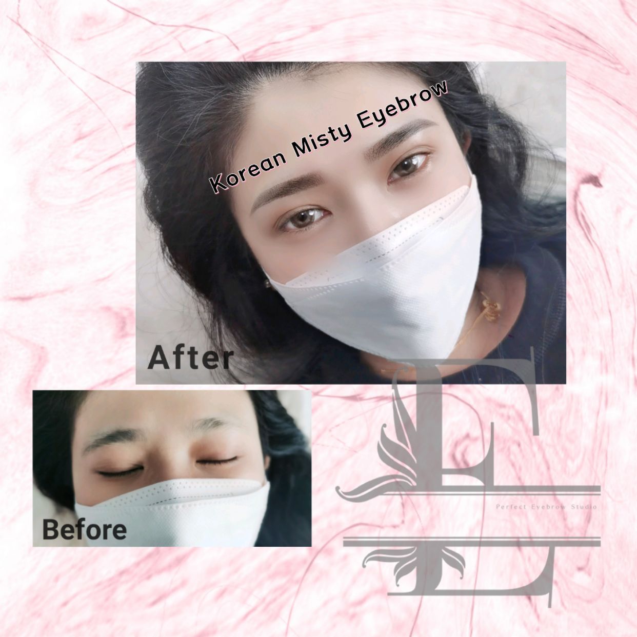 Beauty treatment sample photo 4